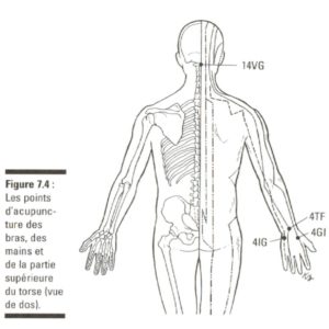 4 points à connaître sur la névralgie cervico-brachiale